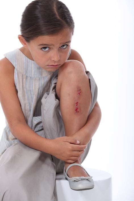 My Child Was Injured at School! Can I Bring a NJ Personal Injury Suit?
