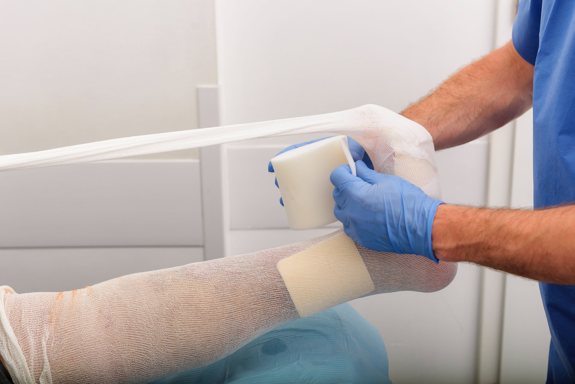 foot being wrapped in gauze before a cast is put on