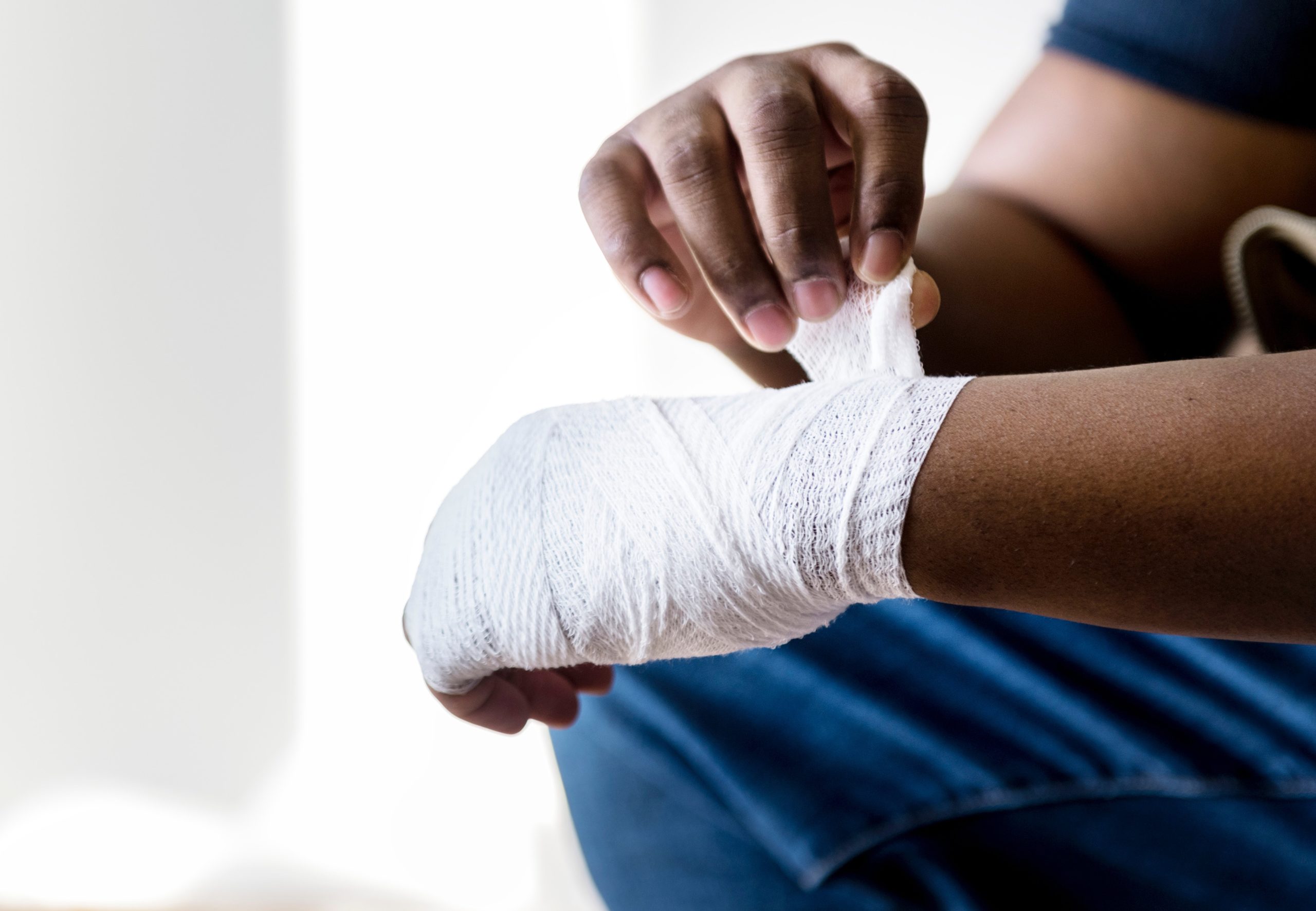 image of an arm injury caused by a slip and fall